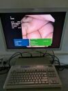 OLYMPUS GIF-2T160 Gastroscope