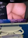 OLYMPUS GF-UCT260 Gastroscope