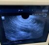 OLYMPUS GF-UCT260 Gastroscope