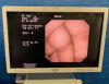 OLYMPUS GF-UCT240 Gastroscope
