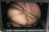 FUJINON EG-530WR Gastroscope