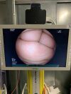 FUJINON EG-530UR2 Gastroscope