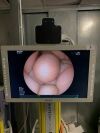 FUJINON EG-530UR2 Gastroscope