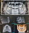 VATECH PaX-i3D Smart Dental CT