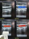 ACUSON 6L3 Ref 0824112 Linear Array Ultrasound Transducer