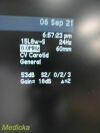 ACUSON Siemens Medical  15L8W Linear Array Ultrasound Transducer