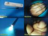 JARIT 10mm x 0° Rigid Telescope Laparoscope