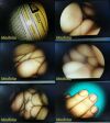 JARIT 10mm x 0° Rigid Telescope Laparoscope