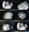 JARIT Rigid Telescope, 10mm x 0° W/ Storage Case *TESTED* ~ Laparoscope