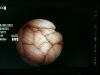 FUJINON FB-120P Endoscope
