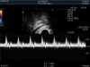 HITACHI CC41R1 Ultrasound Transducer