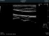 HITACHI SML44 Ultrasound Transducer