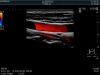 HITACHI SML44 Ultrasound Transducer