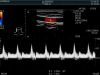 HITACHI SML44 Ultrasound Transducer