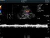 HITACHI C252 Ultrasound Transducer