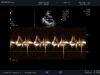 HITACHI S11 Ultrasound Transducer