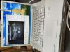 TERASON T3000 Ultrasound - Vascular - Small Parts