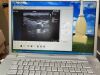 TERASON T3000 Ultrasound - Vascular - Small Parts