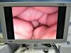 LINVATEC IM3300 O/R Camera
