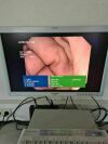 OLYMPUS GIF-XTQ160 EVIS EXERA Gastroscope