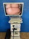 OLYMPUS CV-180, CLV-180, GIF-H180J and CF-H180AL Complete HD Tower Endoscope system