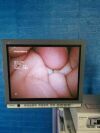 OLYMPUS OTV-S7 Pro With CLV S40PRO COMPLETE WORKSTATION