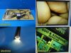 OLYMPUS A50001A VISERA10mm x 0°Rigid Telescope Laparoscope