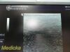 GE HEALTHCARE 7L Model 2302648 Linear Array Ultrasound Transducer
