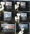 GE HEALTHCARE 7L Model 2302648 Linear Array Ultrasound Transducer