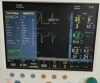 DATEX-OHMEDA GE Aisys Anesthesia Machine