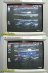 GE 546L (2153405) Linear Array 3.75-5.0 Mhz Ultrasound Transducer