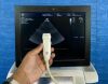 GE E Vivid E9 Ultrasound machine