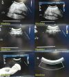 PHILIPS C5-2 Convex Array Ultrasound Transducer