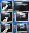 GE LogiQ 9 Diagnostic Ultrasound System W/ 9L, 4C, M7C Transducers ~ Ultrasound - Cardiac - Vascular