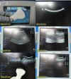 GE LogiQ 9 Diagnostic Ultrasound System W/ 9L, 4C, M7C Transducers ~ Ultrasound - Cardiac - Vascular