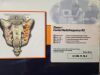 KIMBERLY-CLARK SIK-17-75-4 SInergy Cooled Radiofrequency Kit (X)