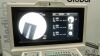 OEC 9600 Super C with Flat Monitors upgrade C-Arm