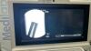 OEC 9600 Super C with Flat Monitors upgrade C-Arm