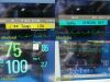 PHILIPS M3001A Option A02 C06 MMS (NBP, IBP, SpO2, Temp, ECG) Module