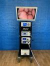 STRYKER 1288HD Laparoscopy System - Working Complete Laparoscope