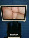 STRYKER 1x 1488HD Camera Laparoscope