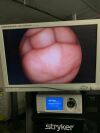 KARL STORZ Karl 11292DE1 Choledochoscope