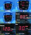 GE/DINAMAP DPC 420N-EN ,W/ New SpO2/NBP Leads,Power Supply~Procare Monitor