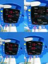 GE/DINAMAP DPC 420N-EN ,W/ New SpO2/NBP Leads,Power Supply~Procare Monitor
