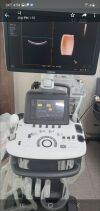 SARANO H60 Ultrasound - OB / GYN