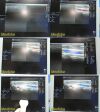 GE HEALTHCARE GE M12L Matrix Array Ultrasound Linear Array Ultrasound Transducer