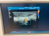 PHILIPS 2013 year  IU22 Cart G.1 ultrasound