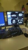 GE Revolution™ CT evo CT Scanner