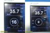 SPACELABS 2010  Ultraview DM3 Masimo Set SpO2 Spot Monitor