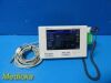 SPACELABS 2010  Ultraview DM3 Masimo Set SpO2 Spot Monitor